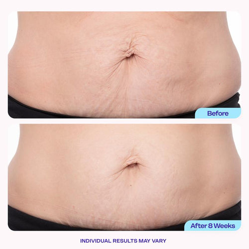 Belly Firming Cream