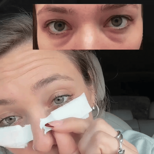 PDRN Reedle Shot Eye Cream