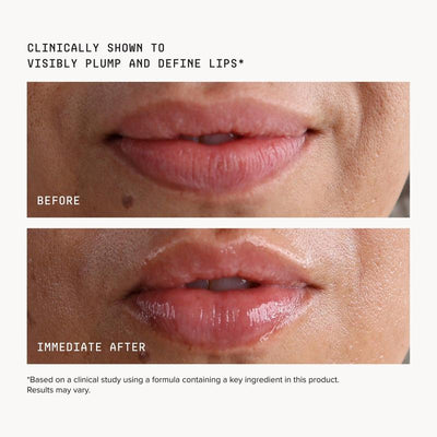 Volumizing Lip Treatment