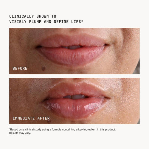 Volumizing Lip Treatment