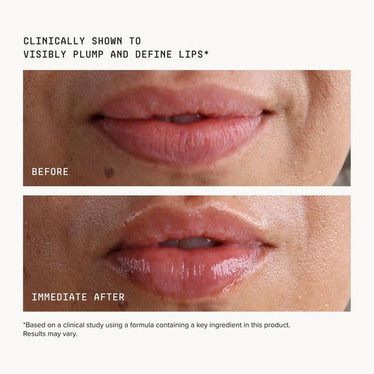 Volumizing Lip Treatment